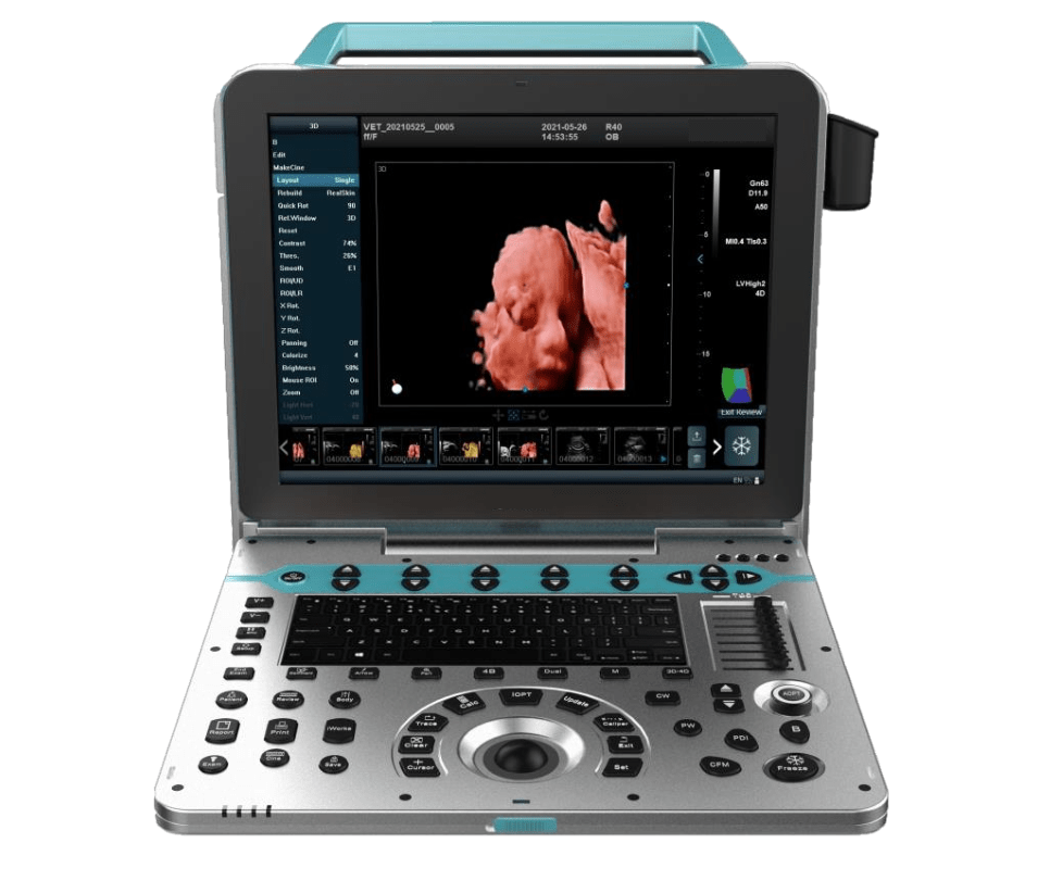 Color Doppler 4D/5D portatile MPUCP5