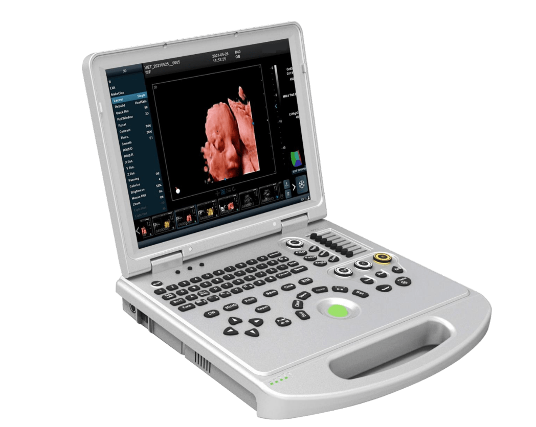 Computer portatile 4D/5D Color Doppler MHUCP-L5