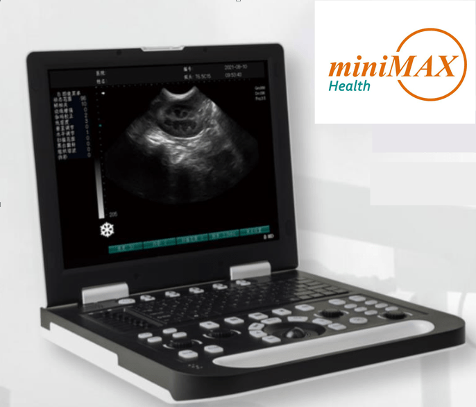 Ultrasound machine (B/W-Laptop)UBP-15